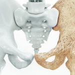 Vsesvitniy den profilaktyky osteoporozu