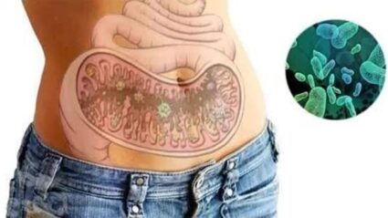 Ходімо далі? Наступна стаття