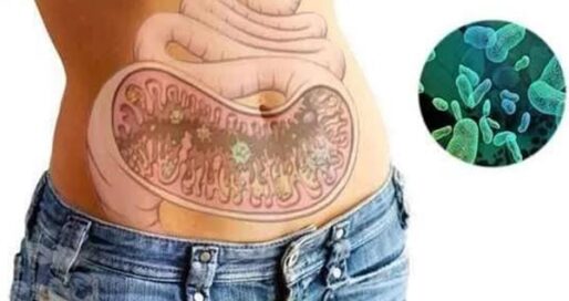 дисбактеріоз